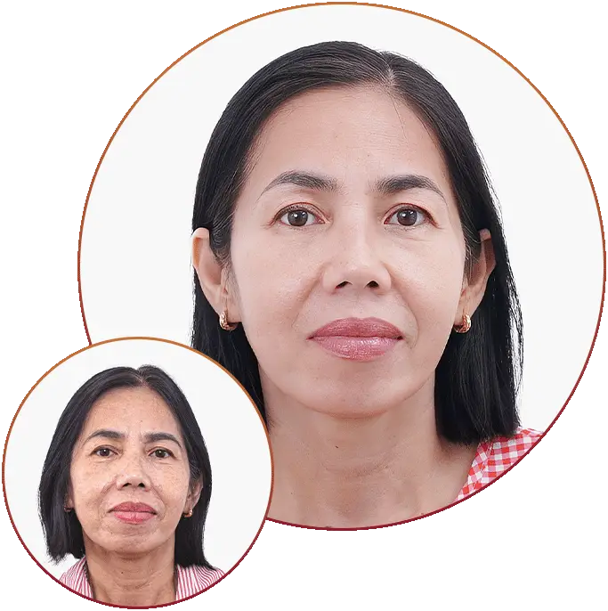 Phòng Khám Da Liễu Thiên Hương – Chuyên Điều Trị Nám Da