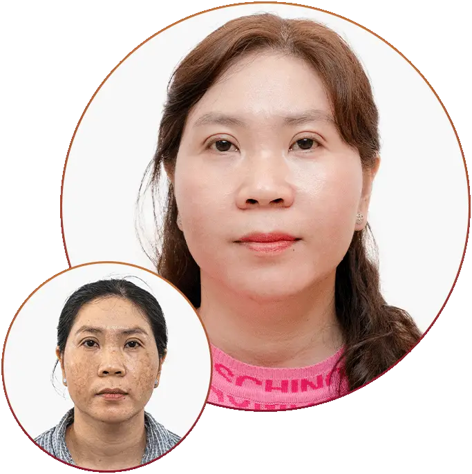 Phòng Khám Da Liễu Thiên Hương – Chuyên Điều Trị Nám Da