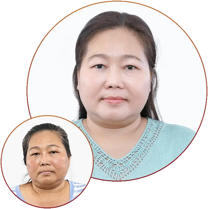 Phòng Khám Da Liễu Thiên Hương – Chuyên Điều Trị Nám Da