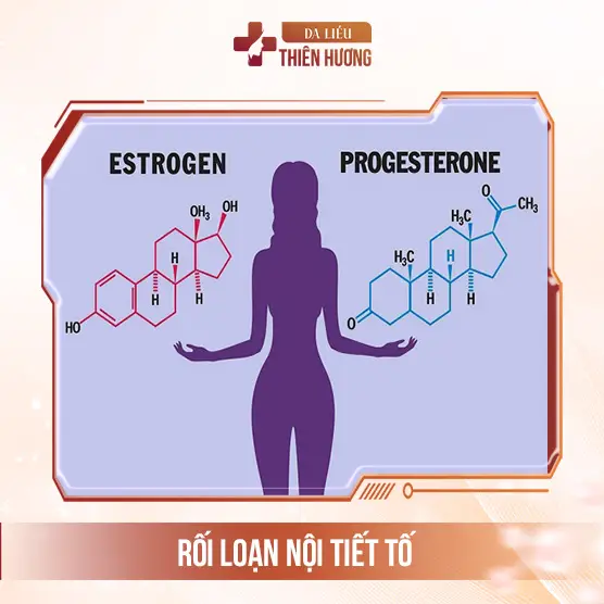 Nám Cánh Bướm Là Gì? Nguyên Nhân, Dấu Hiệu & Cách Điều Trị