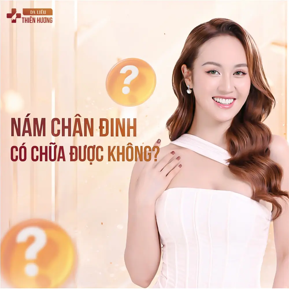 Nám Chân Đinh Là Gì? Nguyên Nhân, Dấu Hiệu & Cách Điều Trị
