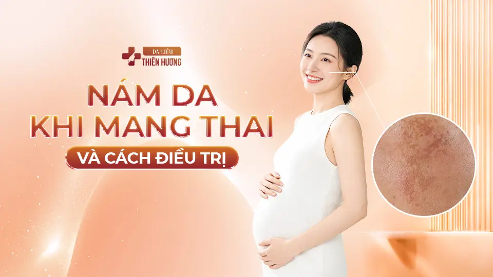 Nám Da Khi Mang Thai: Nguyên Nhân, Cách Phòng Ngừa & Điều Trị An Toàn