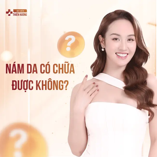 3 Loại Nám Da Phổ Biến: Đặc Điểm, Nguyên Nhân & Cách Nhận Biết