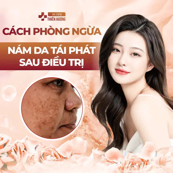 3 Loại Nám Da Phổ Biến: Đặc Điểm, Nguyên Nhân & Cách Nhận Biết
