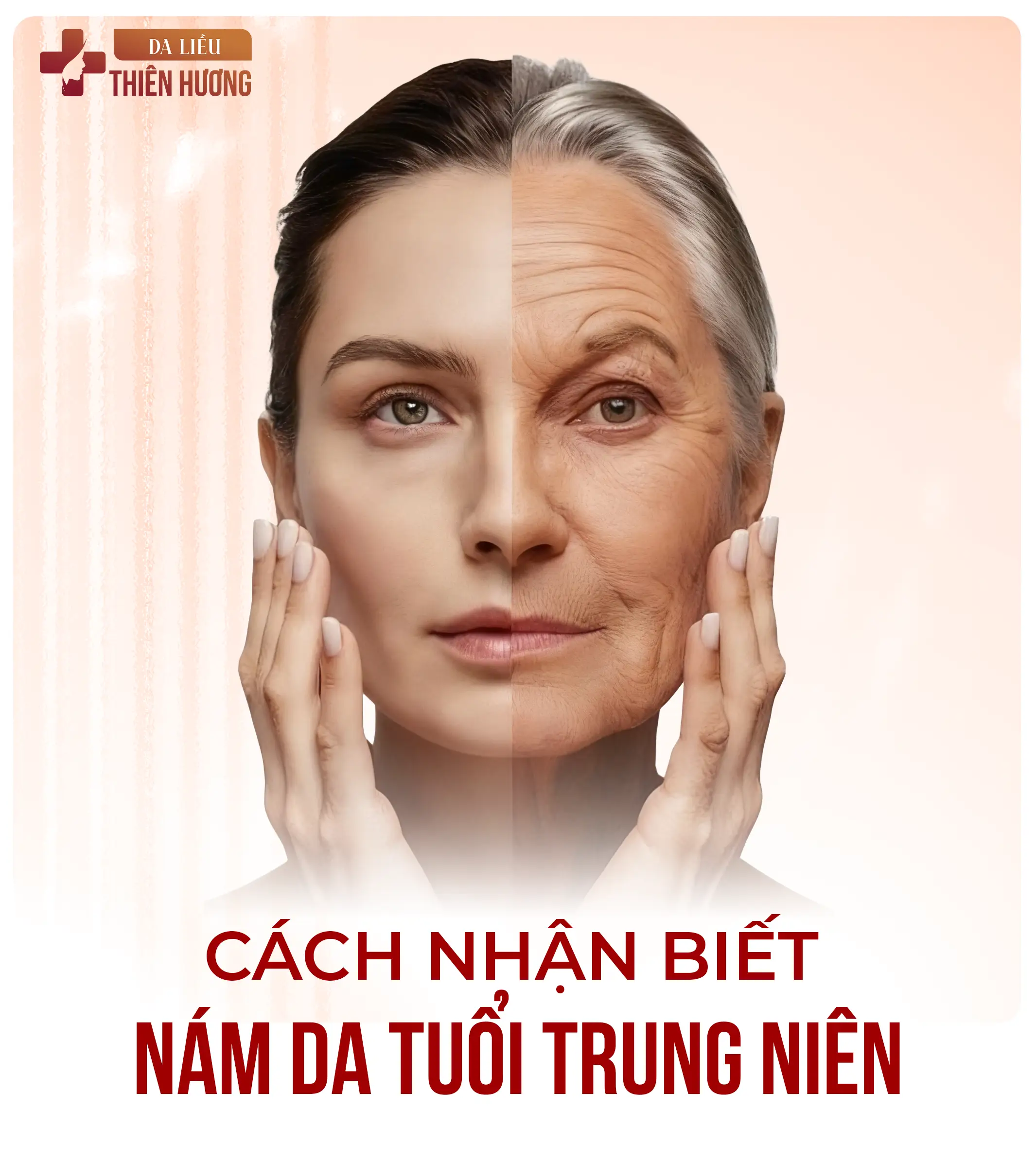 Nám Da Tiền Mãn Kinh: Nguyên Nhân, Cách Nhận Biết & Điều Trị Hiệu Quả