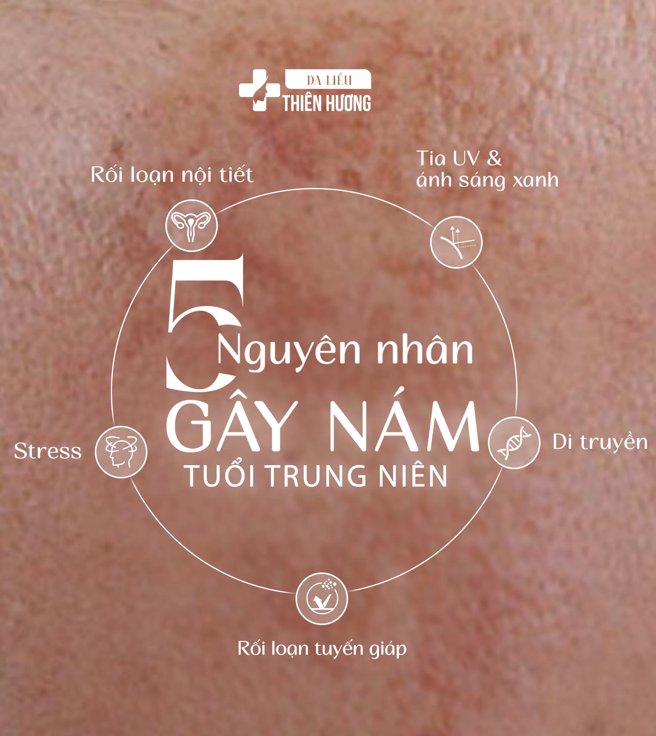Nám Da Tiền Mãn Kinh: Nguyên Nhân, Cách Nhận Biết & Điều Trị Hiệu Quả