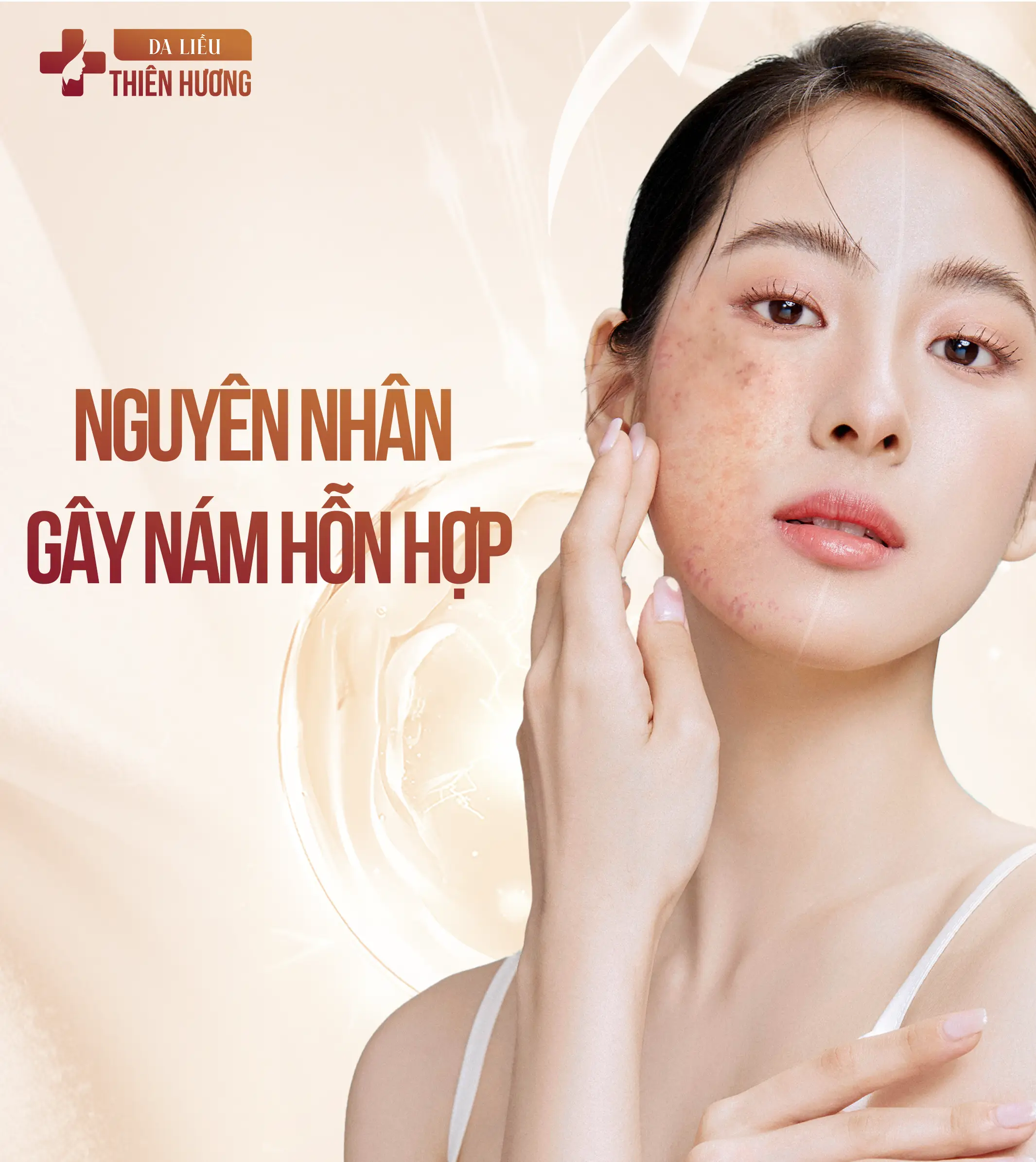 Nám Hỗn Hợp Là Gì? Dấu Hiệu Nhận Biết & Cách Điều Trị Dứt Điểm