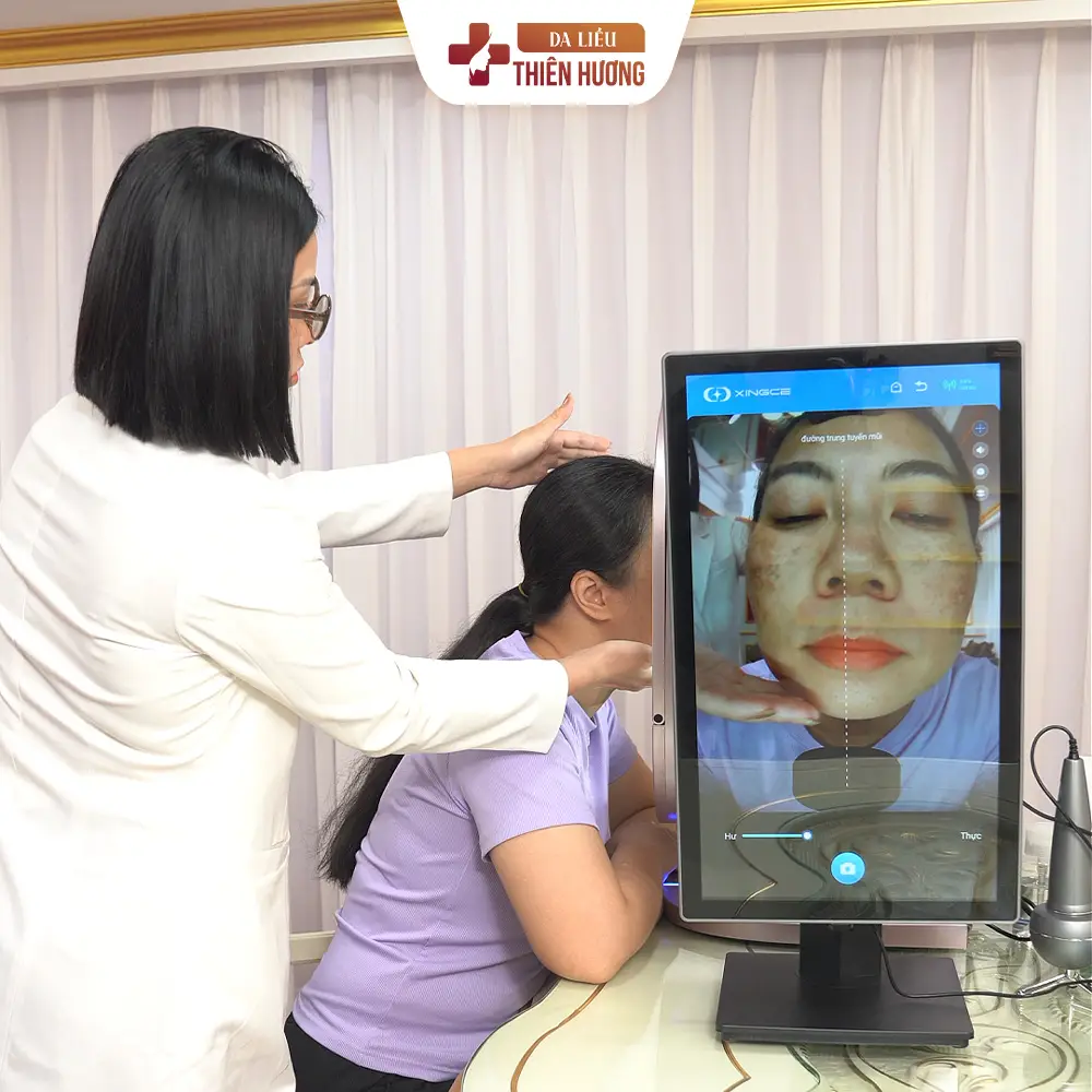 Nám Hori (Bớt Hori): Dấu Hiệu Nhận Biết, Nguyên Nhân & Cách Điều Trị