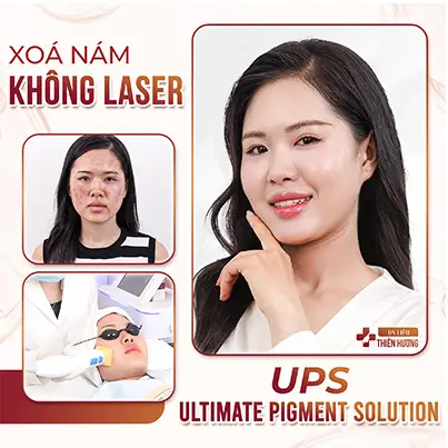Nám Khói Là Gì? Nguyên Nhân, Dấu Hiệu & Cách Điều Trị