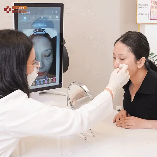 Nám Da Vùng Má: Nguyên Nhân, Phân Loại & Cách Điều Trị Hiệu Quả
