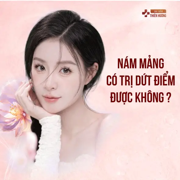Nám Mảng Là Gì? Nguyên Nhân, Dấu Hiệu Nhận Biết & Cách Điều Trị