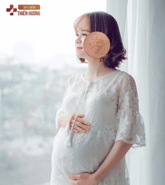Nám Nội Tiết: Nguyên Nhân, Biểu Hiện & Phương Pháp Điều Trị