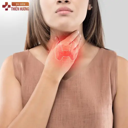 Nám râu là gì? Nguyên nhân, dấu hiệu nhận biết và cách điều trị hiệu quả