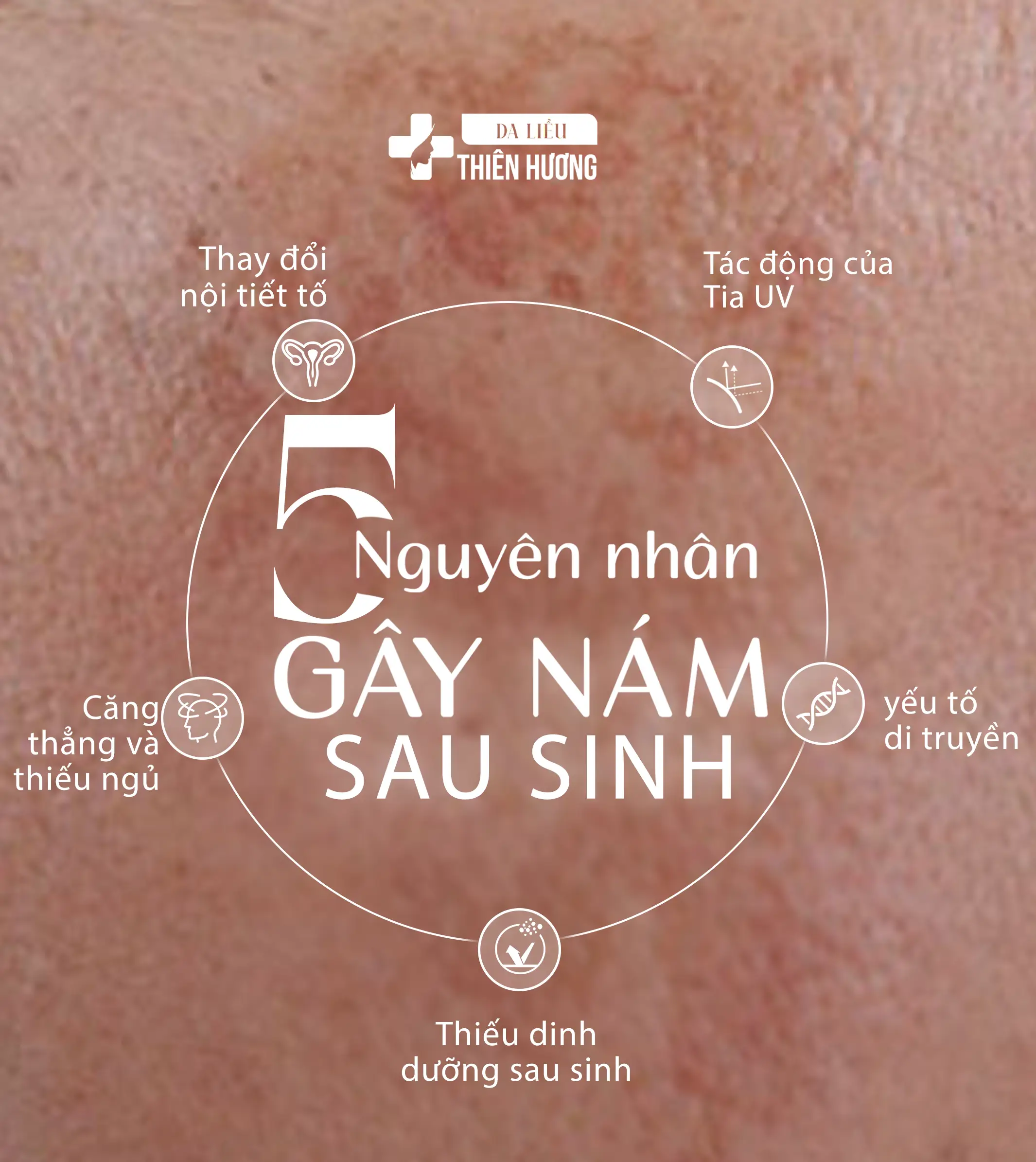 Nám Da Sau Sinh: Nguyên Nhân, Dấu Hiệu Nhận Biết & Cách Điều Trị Hiệu Quả