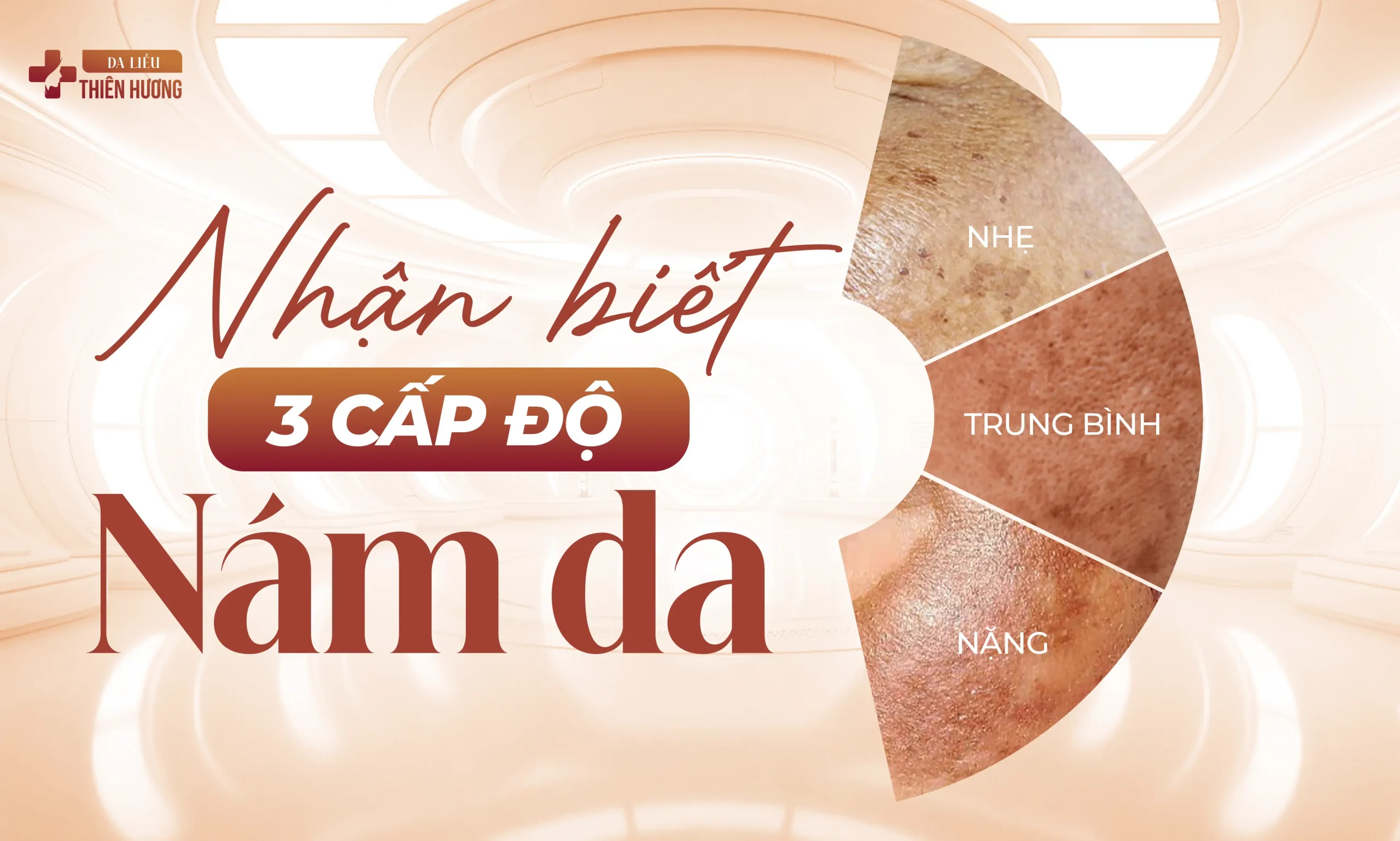 3 Mức Độ Nám Da: Phân Loại, Nhận Biết Và Phác Đồ Điều Trị Phù Hợp