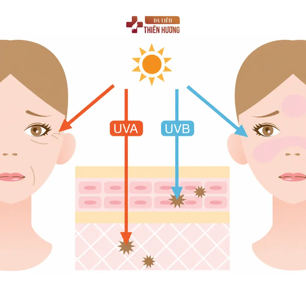 Cấu Trúc Da Nám: Melanocyte, Lớp Thượng Bì Và Cơ Chế Hình Thành Sắc Tố