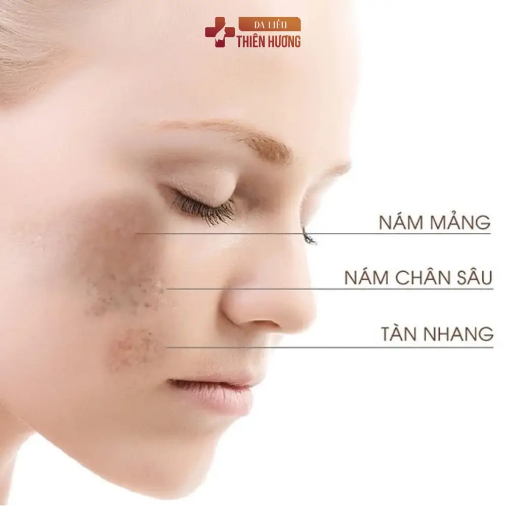 Nám Da Hình Thành Như Thế Nào? Cơ Chế Từ Tế Bào Đến Bề Mặt Da