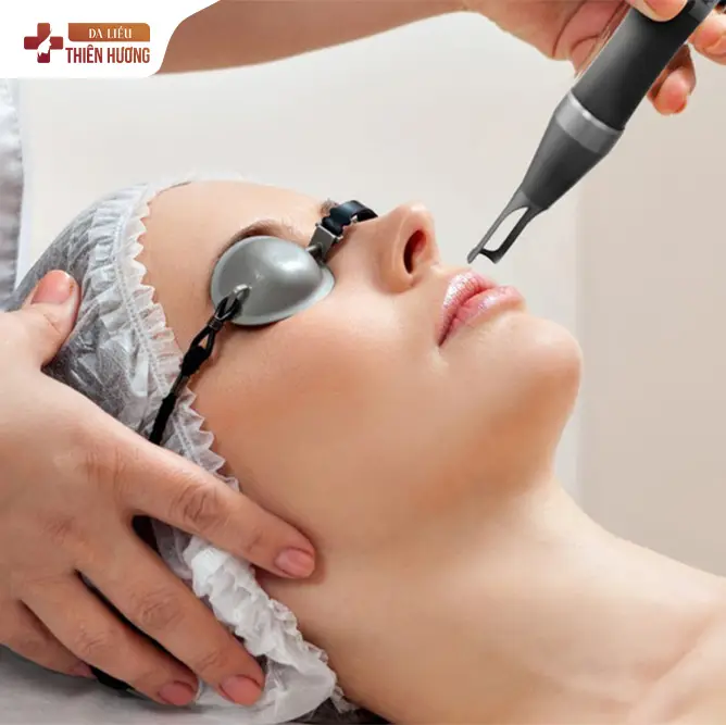 4 Công Nghệ Điều Trị Nám Hiệu Quả Hiện Nay Mà Bạn Nên Biết