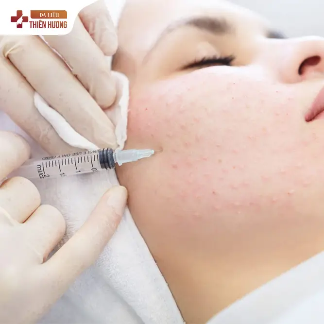 4 Công Nghệ Điều Trị Nám Hiệu Quả Hiện Nay Mà Bạn Nên Biết
