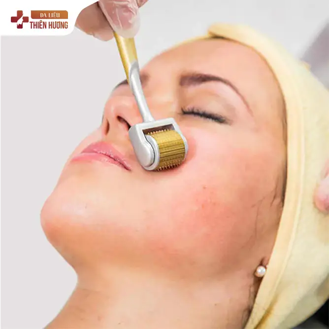 4 Công Nghệ Điều Trị Nám Hiệu Quả Hiện Nay Mà Bạn Nên Biết