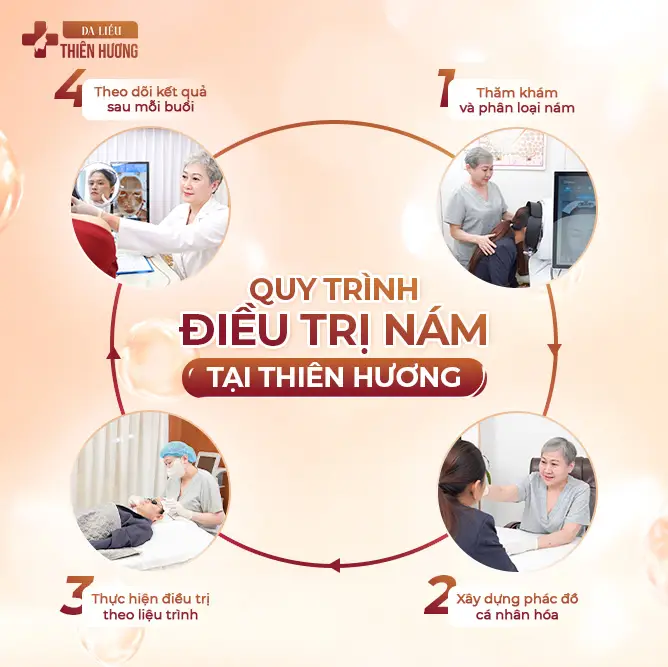 4 Công Nghệ Điều Trị Nám Hiệu Quả Hiện Nay Mà Bạn Nên Biết