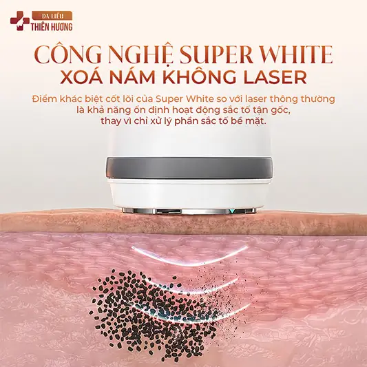 Công Nghệ Super White – Điều Trị Nám Không Xâm Lấn