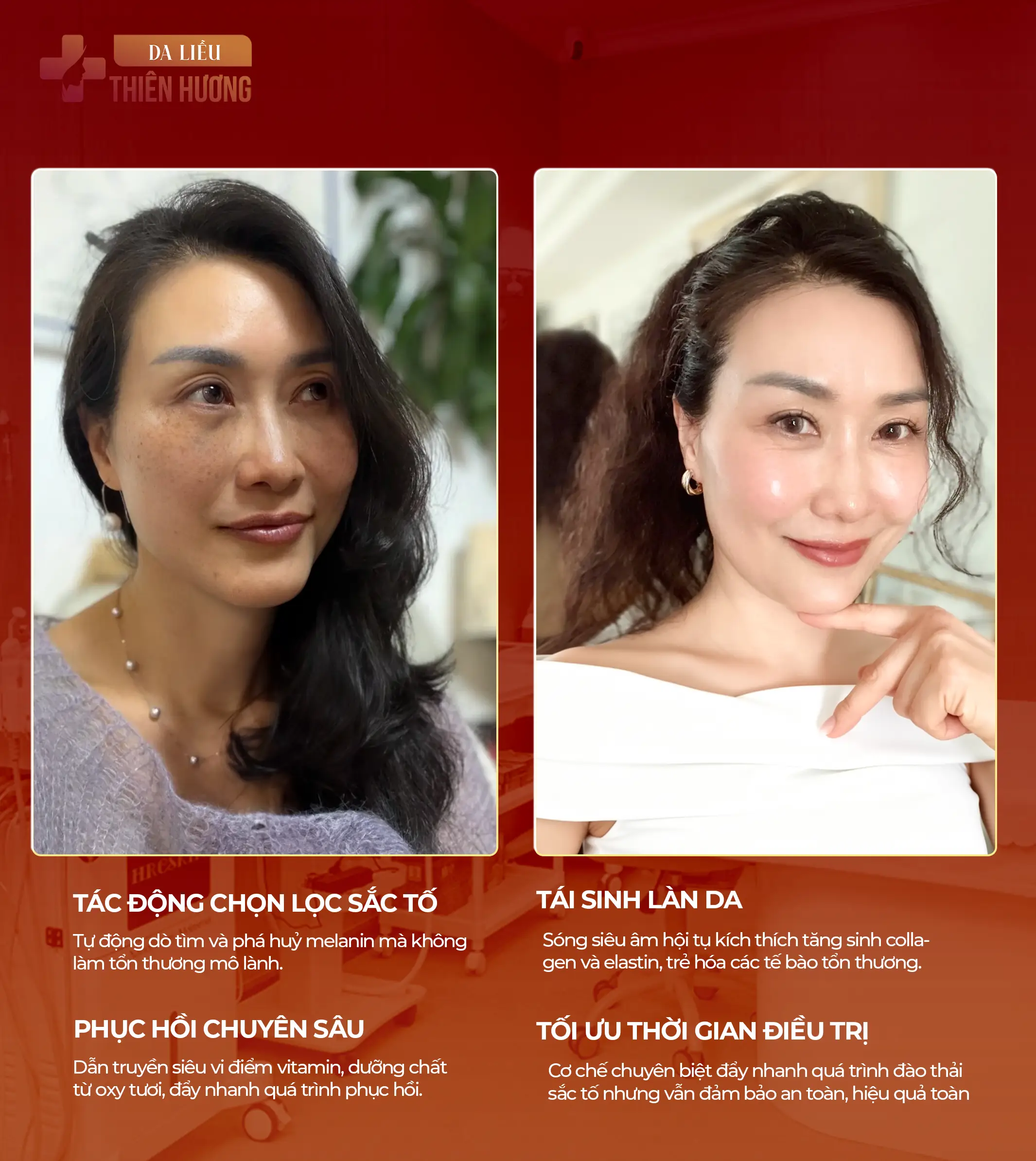 Điều Trị Nám Da: 7 Phương Pháp Hiệu Quả Được Bác Sĩ Tin Dùng