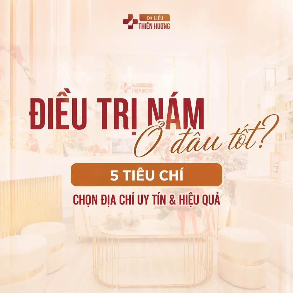 Điều trị nám ở đâu tốt? 5 Tiêu chí chọn địa chỉ uy tín & hiệu quả