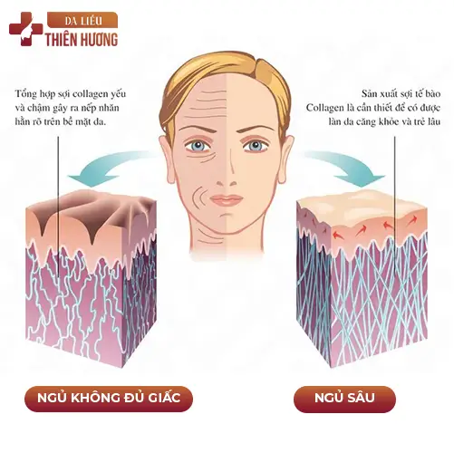 Giấc Ngủ Hỗ Trợ Điều Trị Nám: 5 Cơ Chế Sinh Học Cần Biết