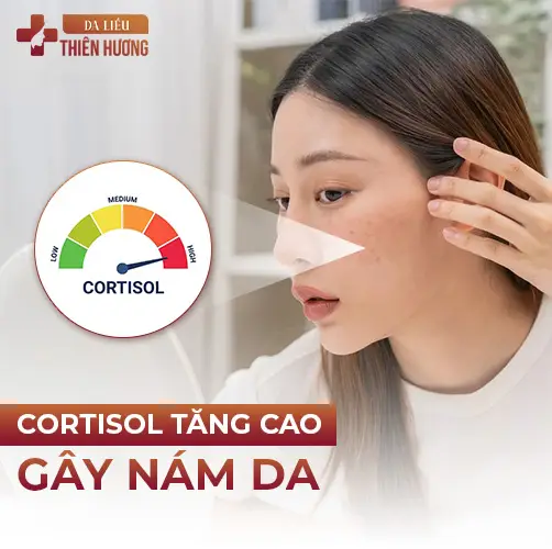 Giấc Ngủ Hỗ Trợ Điều Trị Nám: 5 Cơ Chế Sinh Học Cần Biết