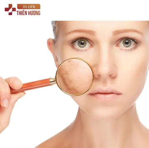 Giấc Ngủ Hỗ Trợ Điều Trị Nám: 5 Cơ Chế Sinh Học Cần Biết