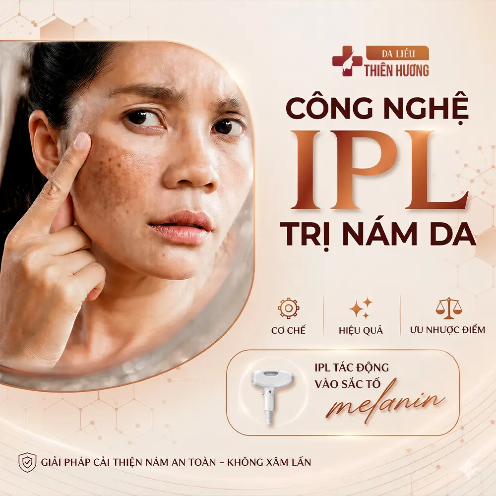 Công nghệ IPL trị nám da: Cơ chế, hiệu quả & ưu nhược điểm