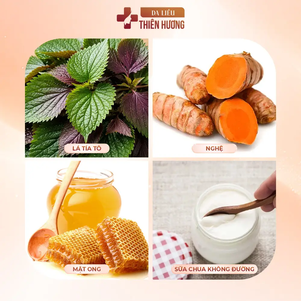 Lá Tía Tô Có Trị Nám Được Không? Hiệu Quả & Giới Hạn Cần Biết