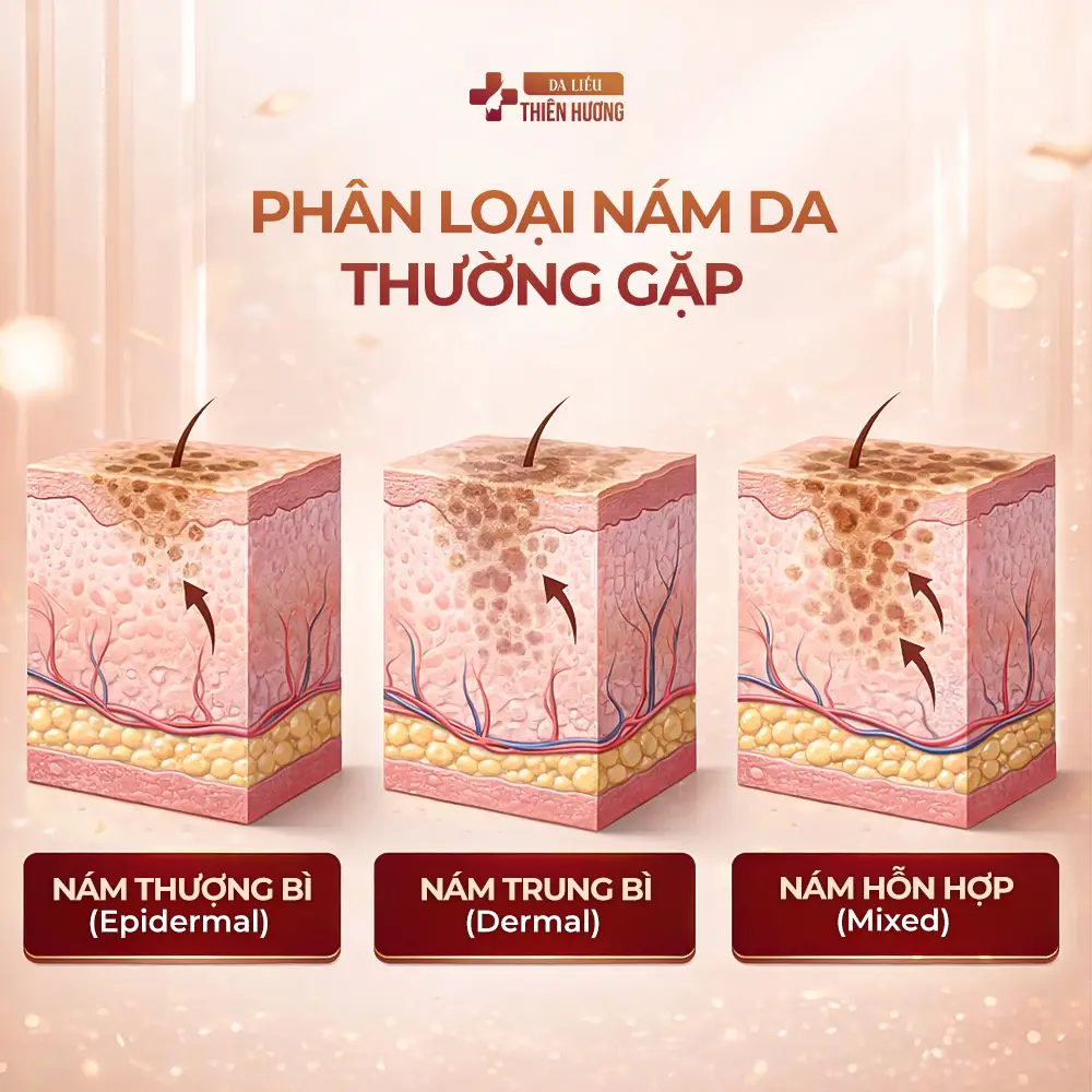 Lăn Kim Trị Nám: Ưu, Nhược Điểm & Hiệu Quả Điều Trị