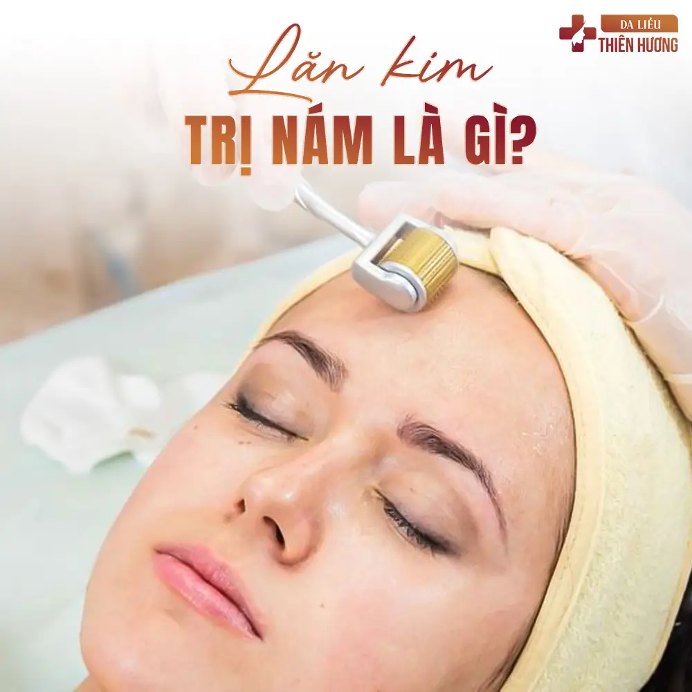 Lăn Kim Trị Nám: Ưu, Nhược Điểm & Hiệu Quả Điều Trị