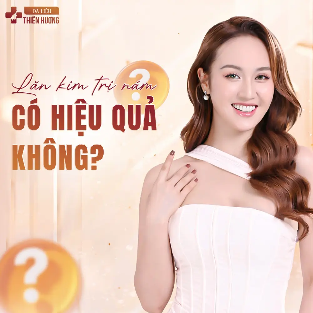 Lăn Kim Trị Nám: Ưu, Nhược Điểm & Hiệu Quả Điều Trị