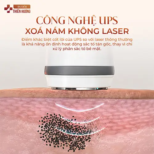 Bắn Laser Trị Nám Có Hiệu Quả Không? Chi Phí Bao Nhiêu?