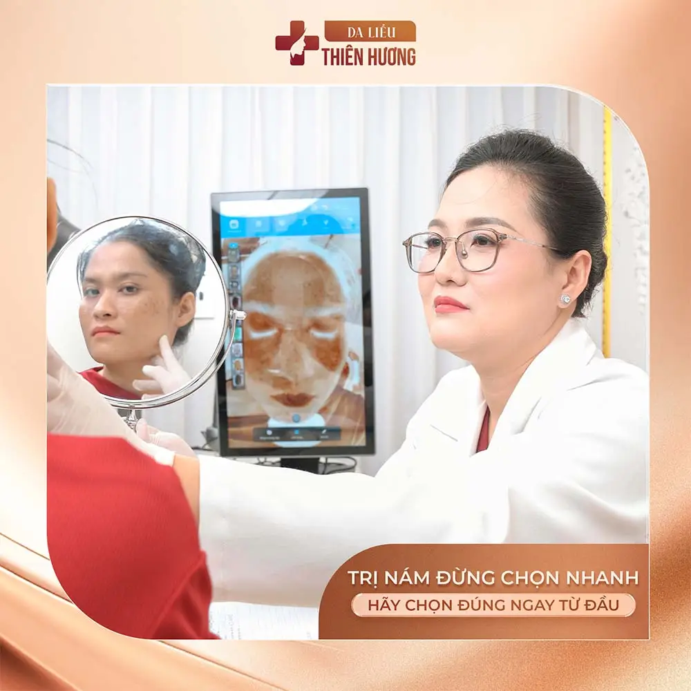 Nám Có Chữa Khỏi Hoàn Toàn Không? Sự Thật Từ Bác Sĩ Da Liễu