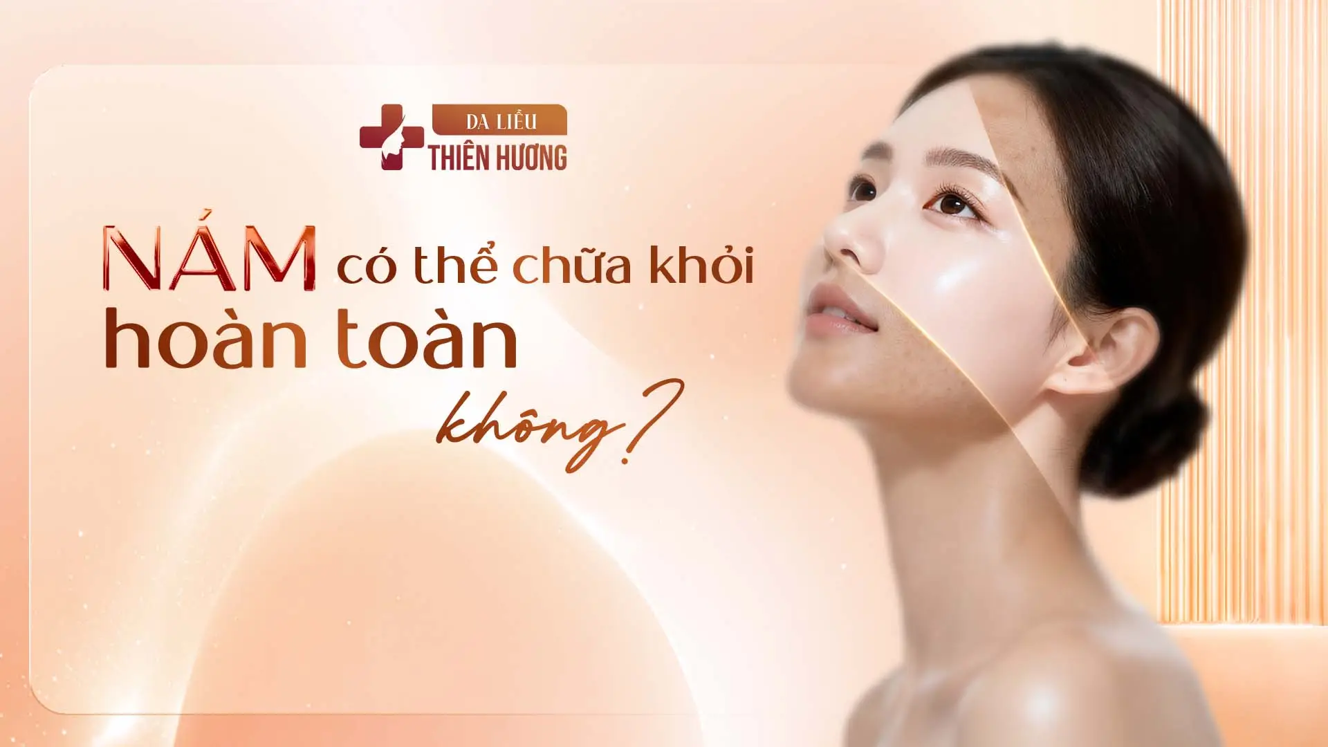 Nám Có Chữa Khỏi Hoàn Toàn Không? Sự Thật Từ Bác Sĩ Da Liễu