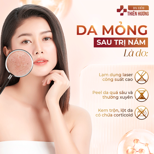 7 Nguyên Nhân Gây Nám Da Mặt Và Cơ Chế Hình Thành Sắc Tố Melanin