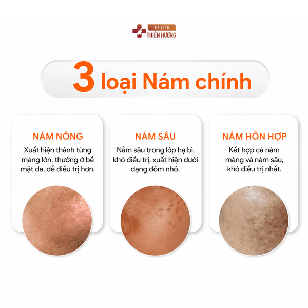 7 Nguyên Nhân Gây Nám Da Mặt Và Cơ Chế Hình Thành Sắc Tố Melanin
