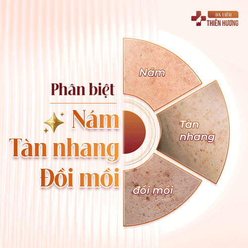 Cách Phòng Ngừa Nám Da: 9 Biện Pháp Hiệu Quả Được Bác Sĩ Khuyến Nghị
