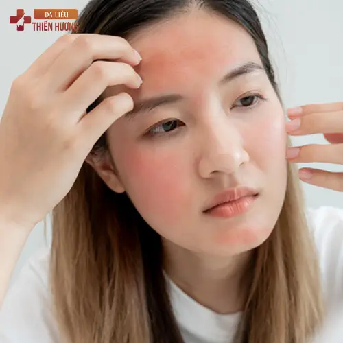 Peel Da Trị Nám: Hiệu Quả & Chi Phí