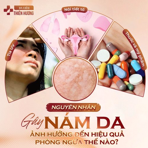 Cách Phòng Ngừa Nám Da: 9 Biện Pháp Hiệu Quả Được Bác Sĩ Khuyến Nghị