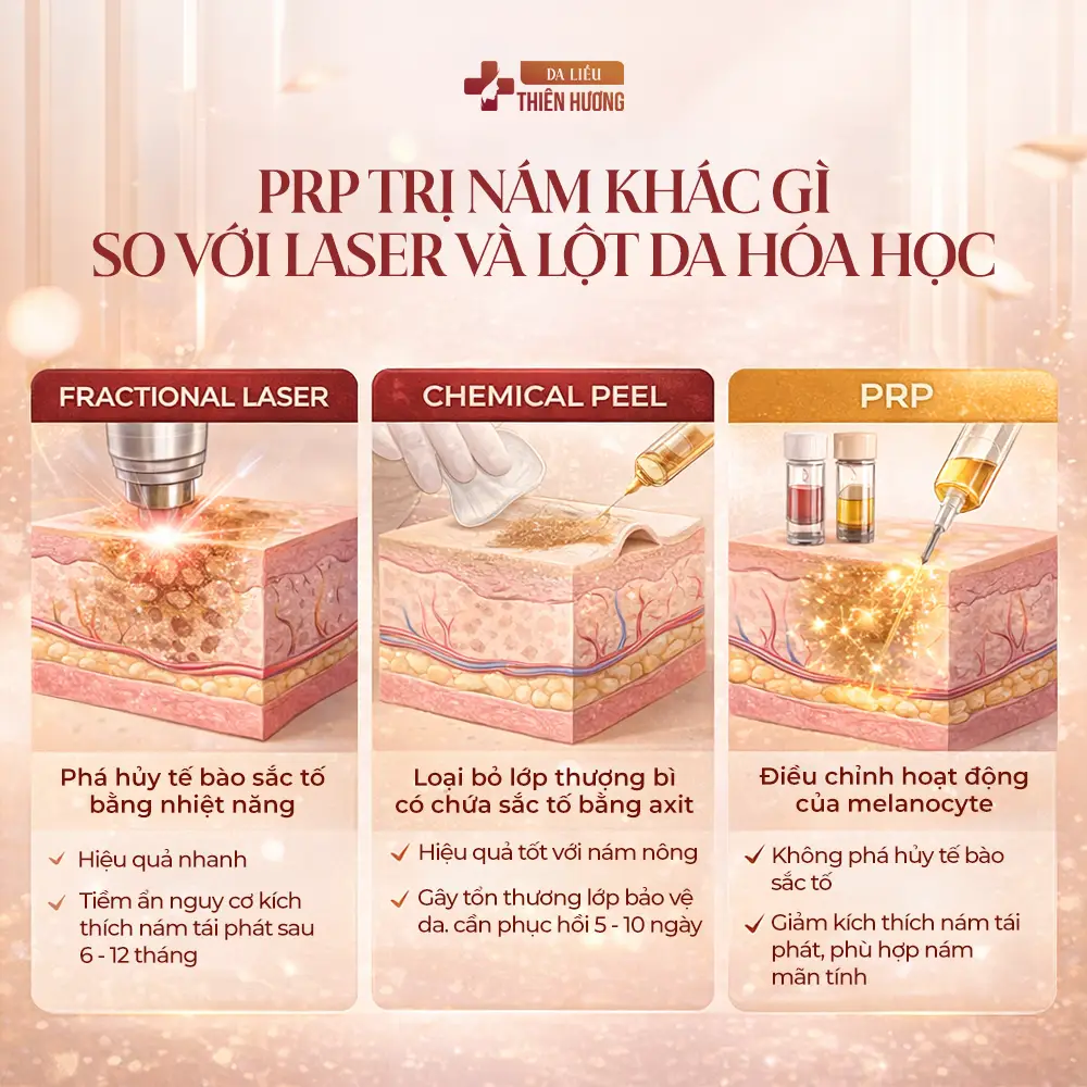 Trị Nám Bằng PRP: Hiệu Quả, Chi Phí & Quy Trình Thực Hiện