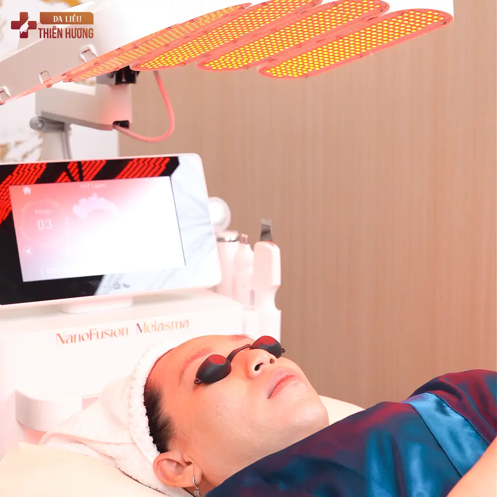 24 Bước Quy Trình Điều Trị Nám Chuẩn Y Khoa Tại Thiên Hương