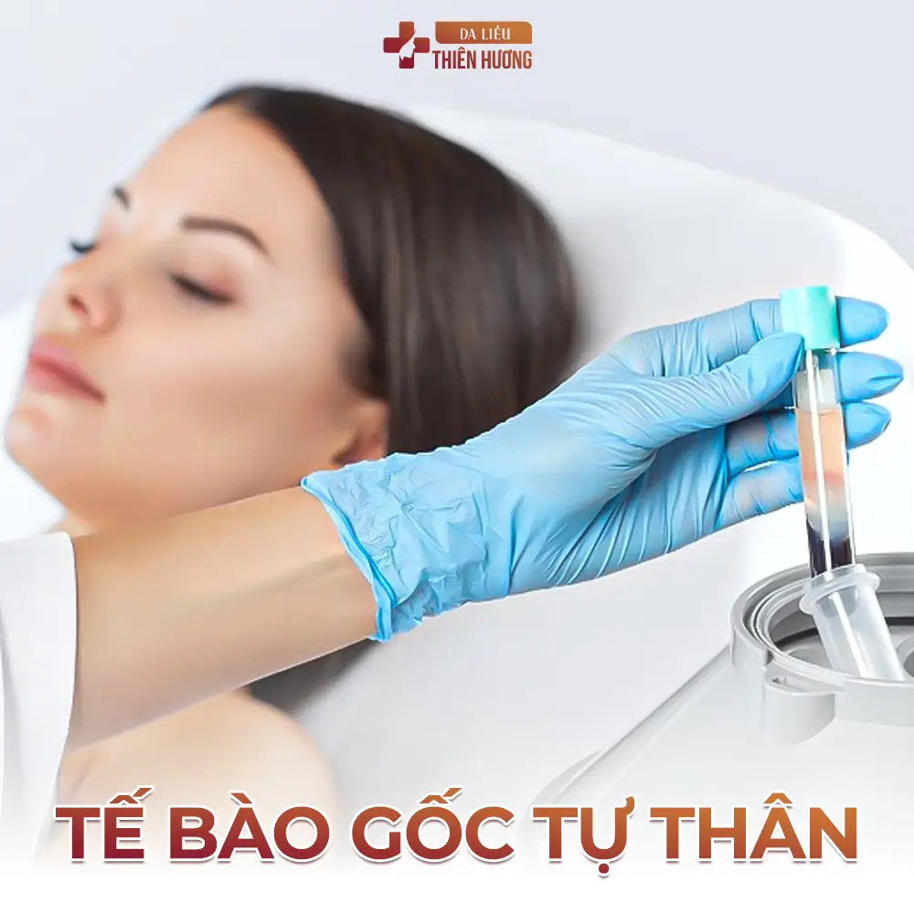 Tế Bào Gốc Trị Nám: Cơ Chế, Phương Pháp & Hiệu Quả Thực Sự