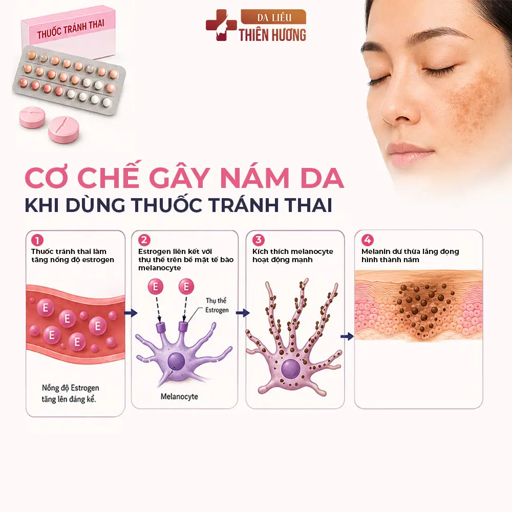 Thuốc Tránh Thai Có Gây Nám Da Không? Sự Thật Ít Ai Biết