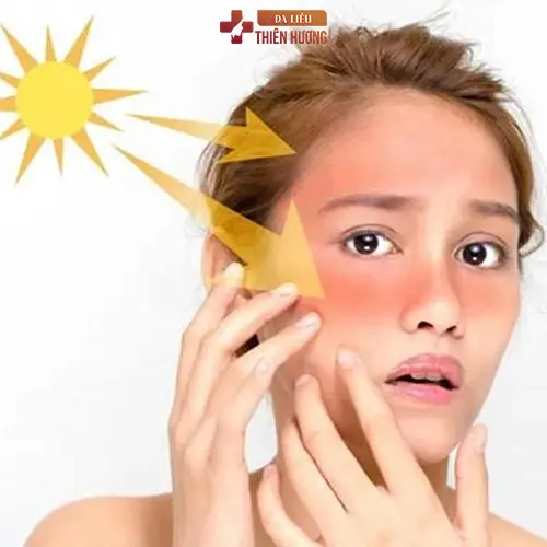Thuốc Tránh Thai Có Gây Nám Da Không? Sự Thật Ít Ai Biết