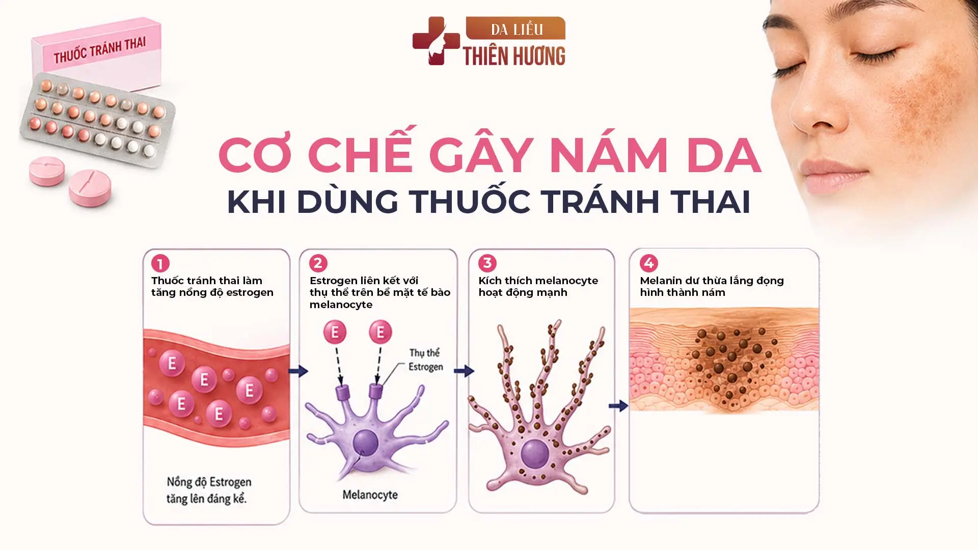 Thuốc Tránh Thai Có Gây Nám Da Không? Sự Thật Ít Ai Biết